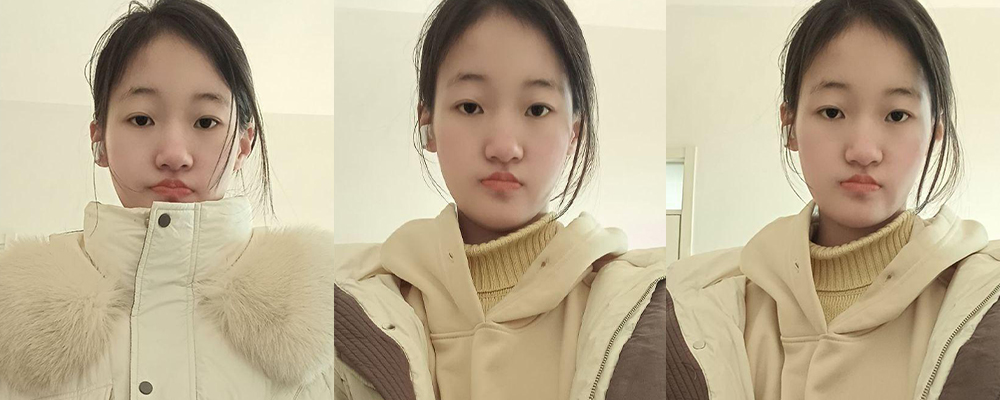 山东临沂电子科技学院药学应届生张雯娟 小小年纪沾染一身性病 面对镜头大胆展示反差一面