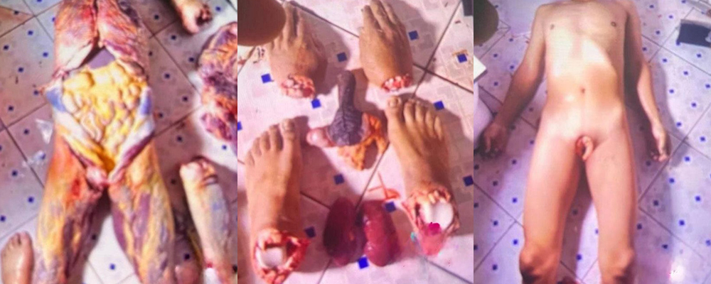 越南屠夫案全过程曝光 受害者Dat肢解后被烹煮食用 各种人体器官近距离拍摄震撼你的眼球 