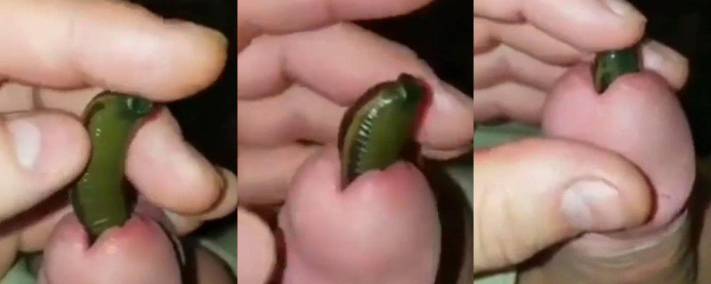 民间出大神 变态小伙挑战血蛭塞马眼  一边撸动鸡巴一边享受另类刺激 看完令人浑身不适 